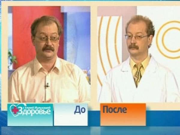 Андрей Продеус до и после похудения