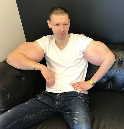 Пораженный тяжелейшим воспалением синтоловый качек Кирилл Терешин удаляет руки-базуки